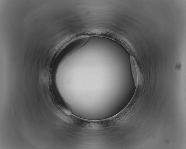 X0000091580444200708201017