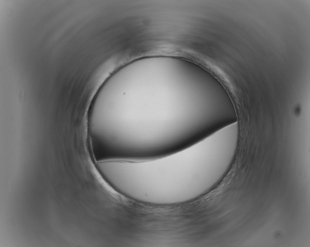 X0000091581479200708201002