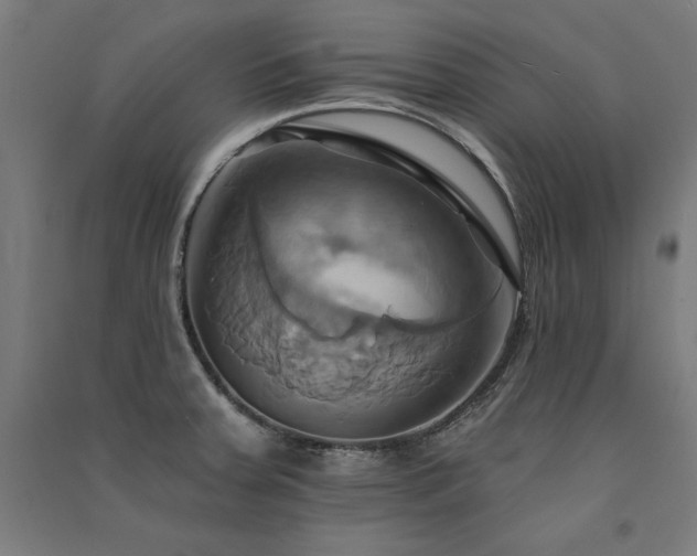 X0000091581379200708201158