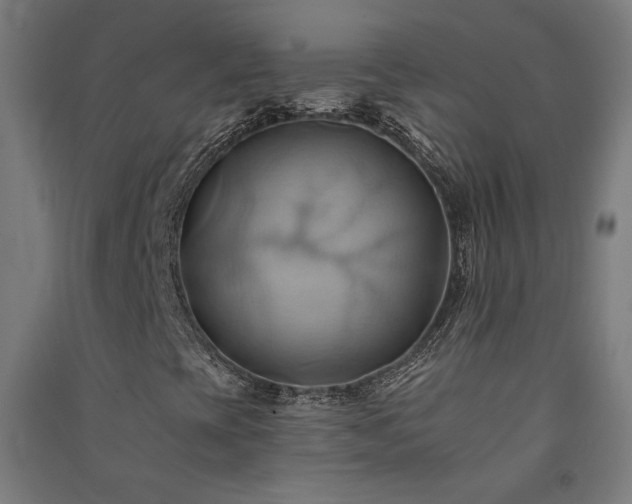 X0000091581393200708201157