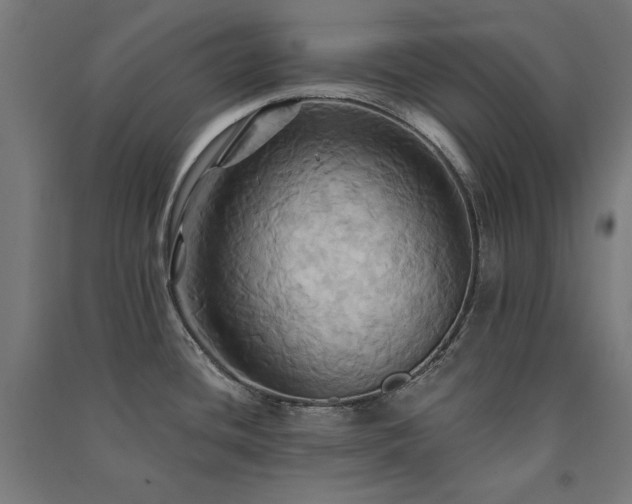 X0000091581436200708201158