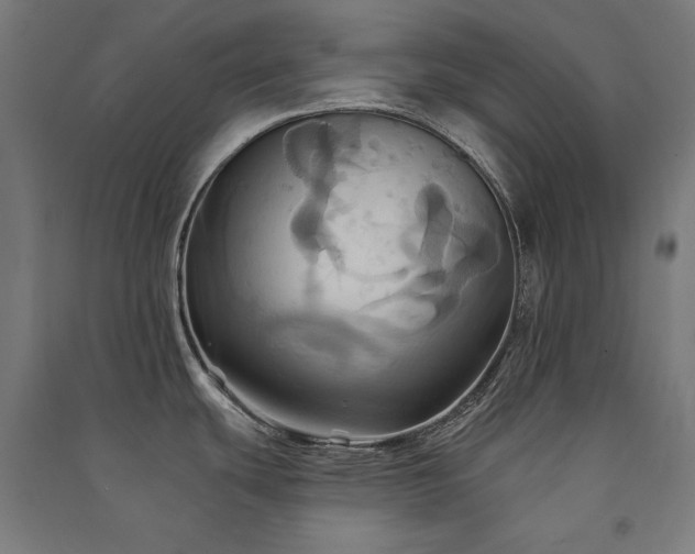 X0000091581439200708201158
