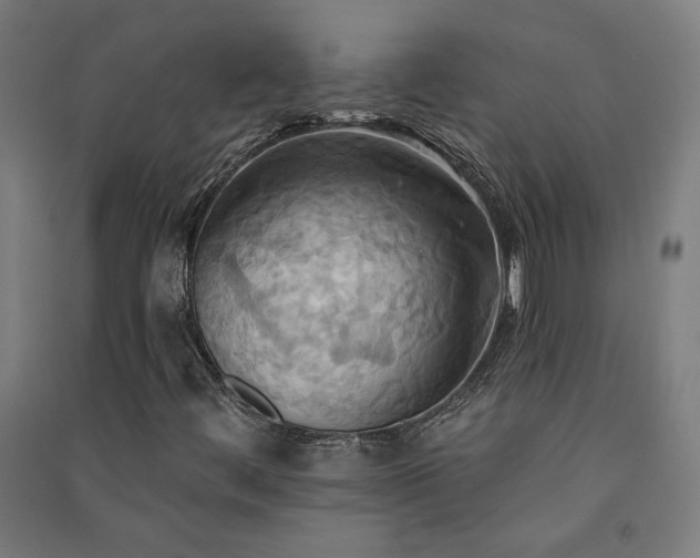 X0000091581444200708201157
