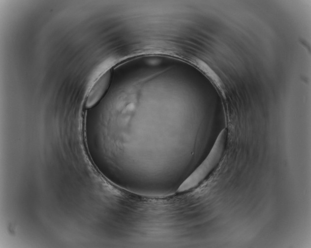 X0000091581096200708271215