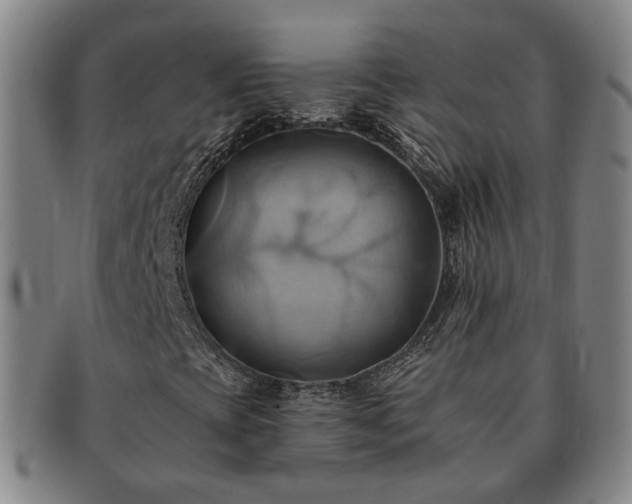 X0000091581393200708271210