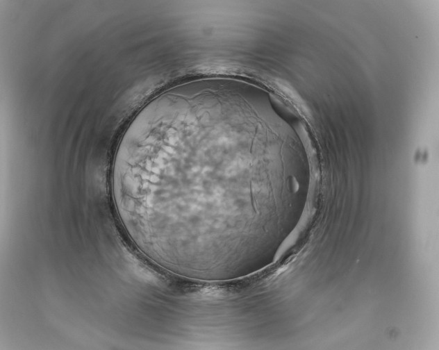 X0000091580441200709051103