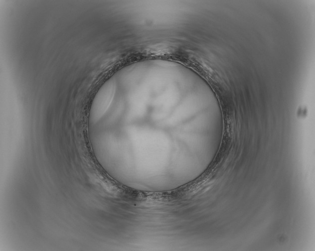 X0000091581393200709051050