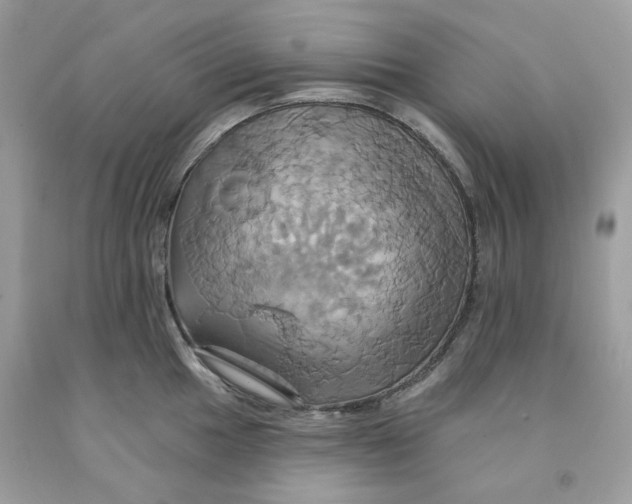 X0000091581049200709101014