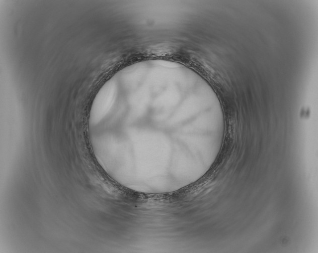 X0000091581393200709101008