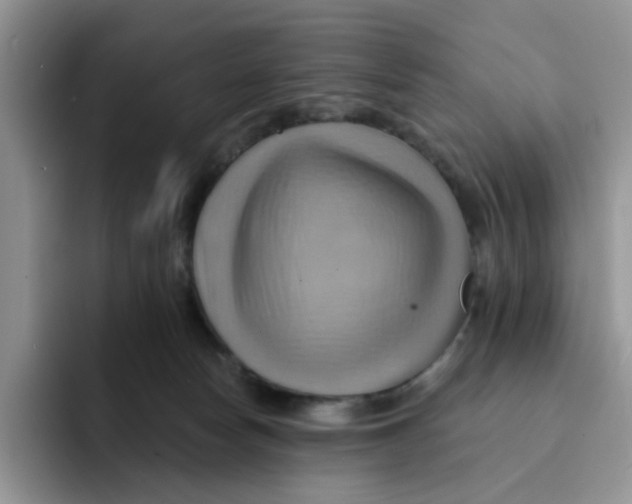X0000091580178200709171122