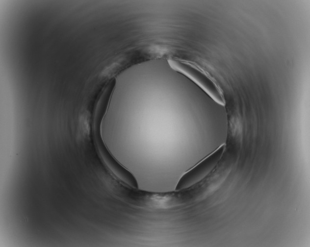 X0000091580570200709171118
