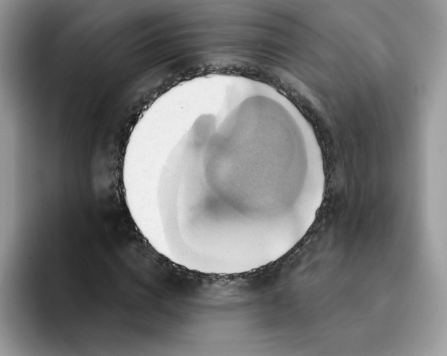 X0000091580824200709171114