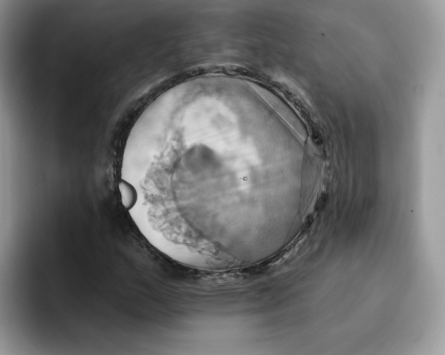 X0000091581159200709171110
