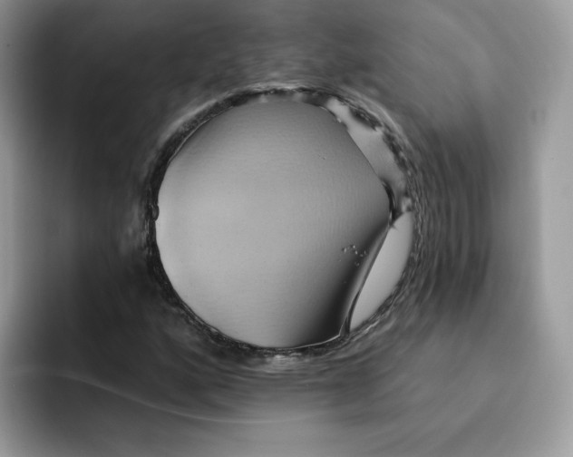 X0000091581160200709171110