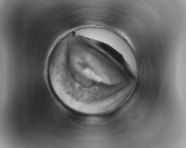 X0000091581379200709171108