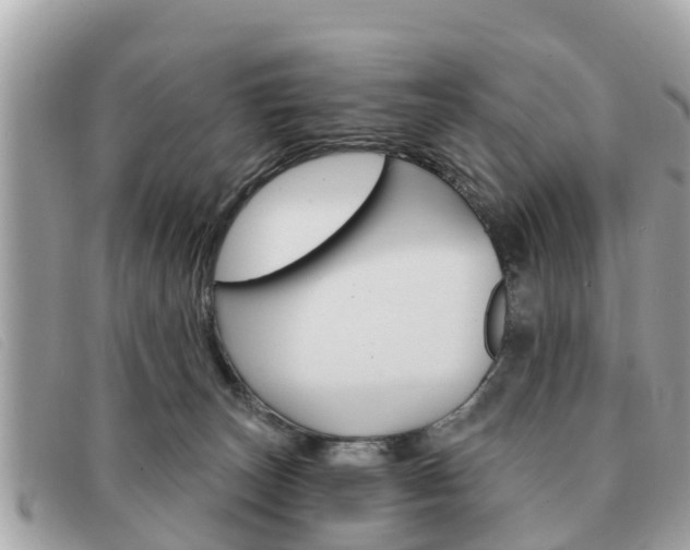 X0000091590179200708201000
