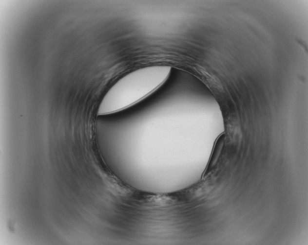 X0000091590379200708200957