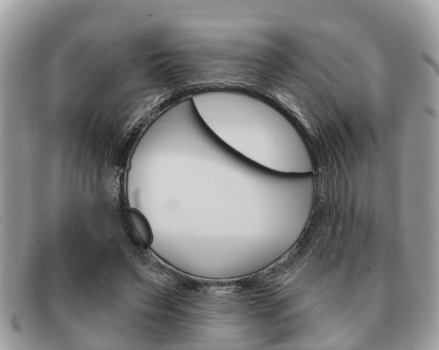 X0000091590495200708200955