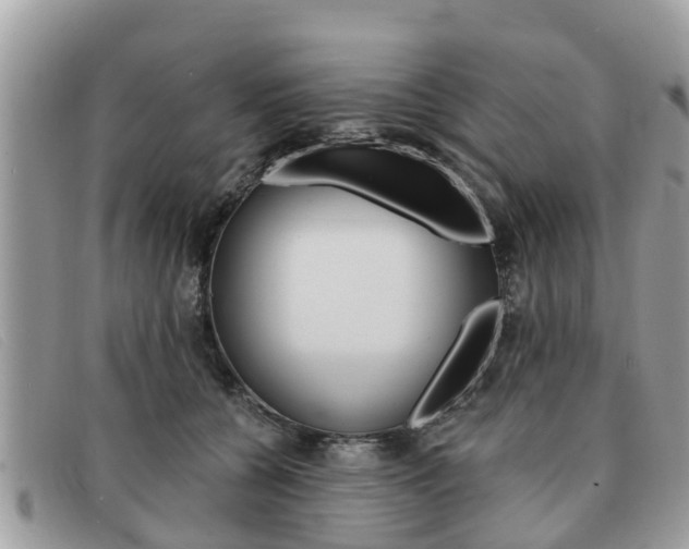 X0000091590560200708200954