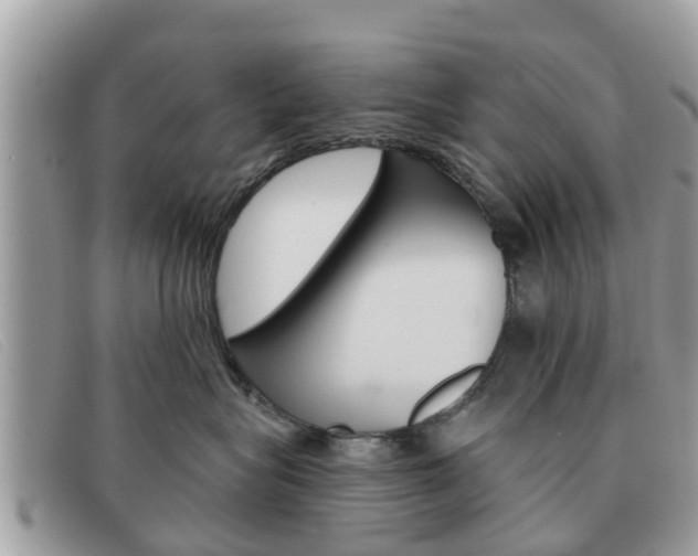 X0000091590575200708200955