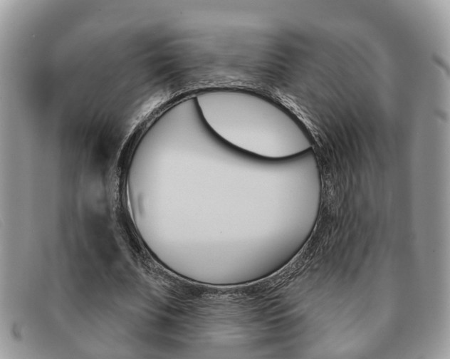 X0000091590679200708200952