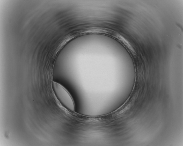 X0000091591049200708200947
