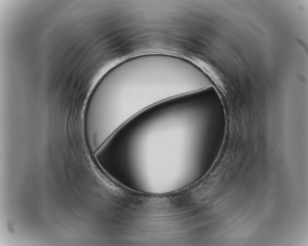 X0000091591238200708200944
