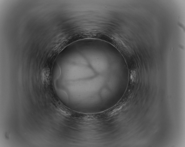 X0000091590867200708271241