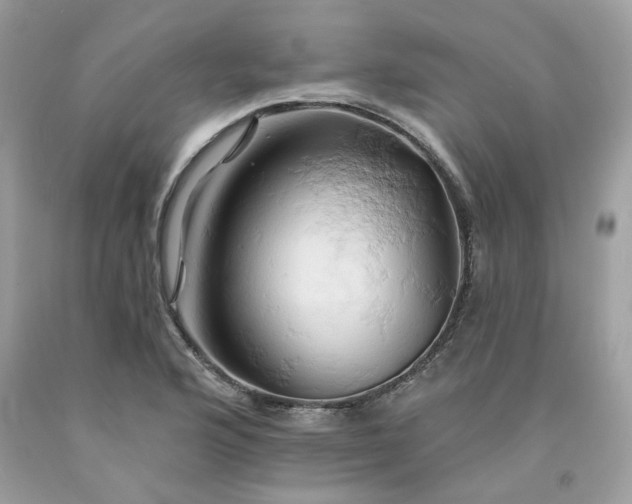 X0000091591176200709051115