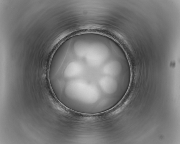 X0000091591017200709101036