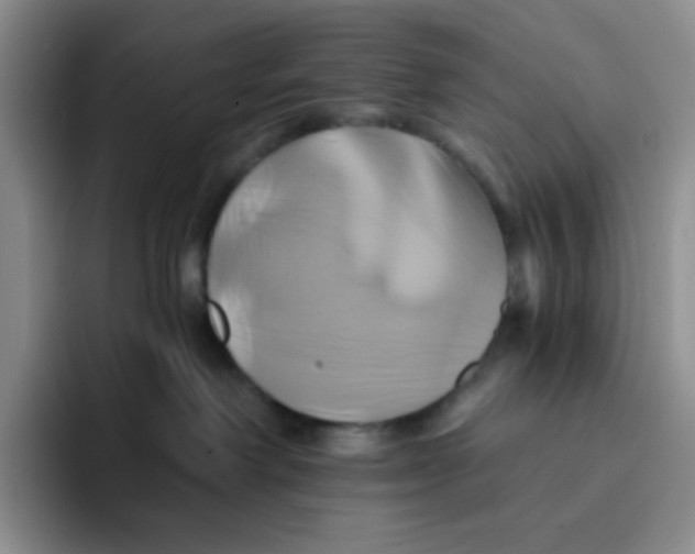 X0000091590238200709171140