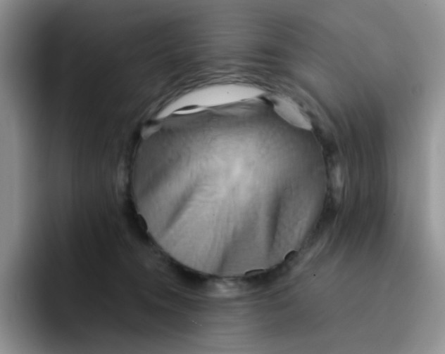 X0000091590372200709171139