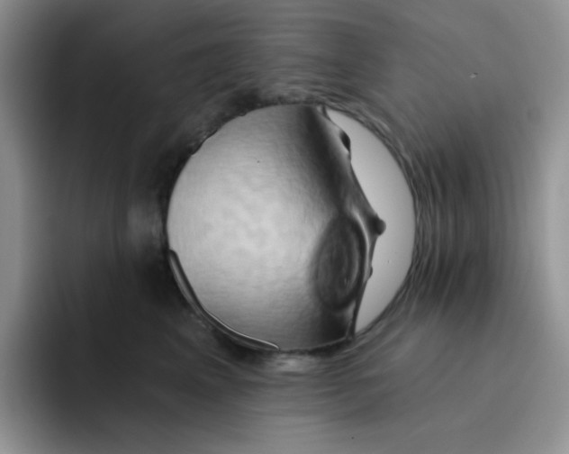 X0000091590617200709171135