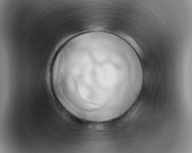 X0000091591051200709171131