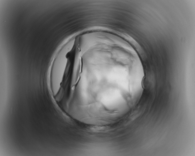 X0000091591199200709171128