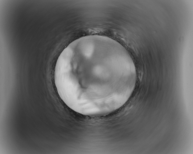 X0000091591393200709171125