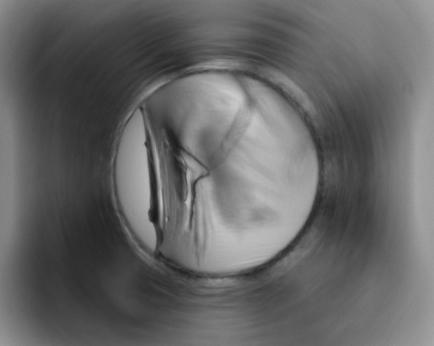 X0000091591425200709171126