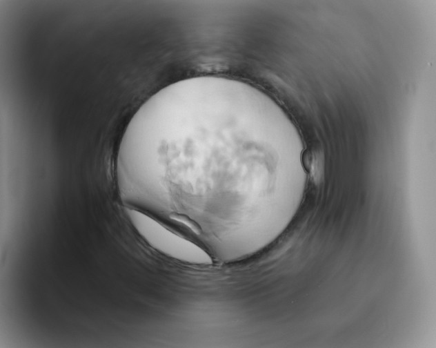 X0000091591444200709171125