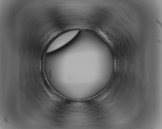 X0000091640205200708230956