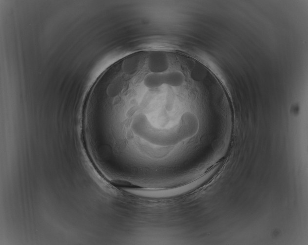 X0000091641195200708231151