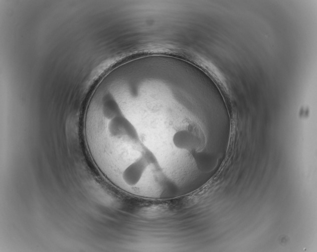 X0000091640155200709060945