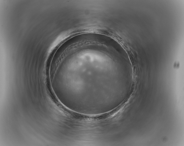 X0000091640198200709060945