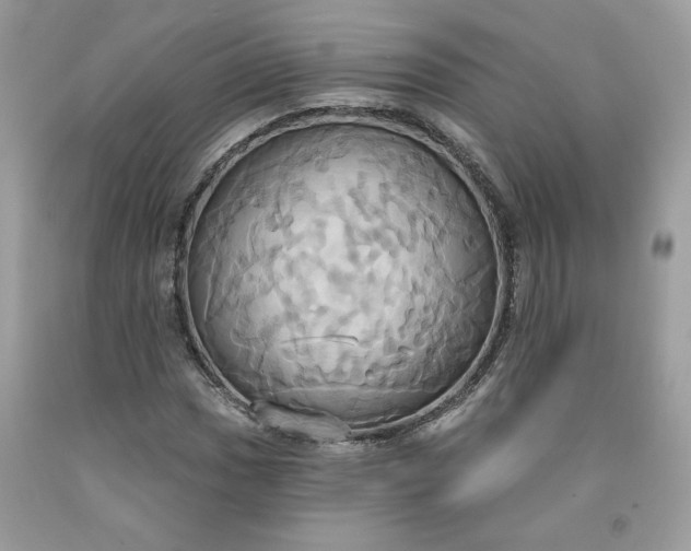 X0000091641017200709060933