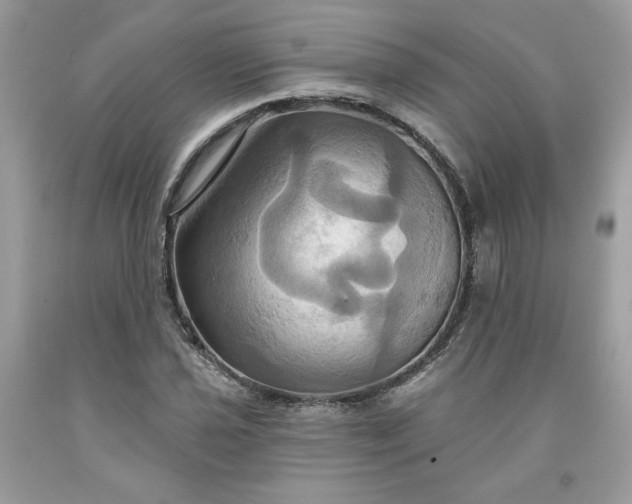 X0000091641021200709060933