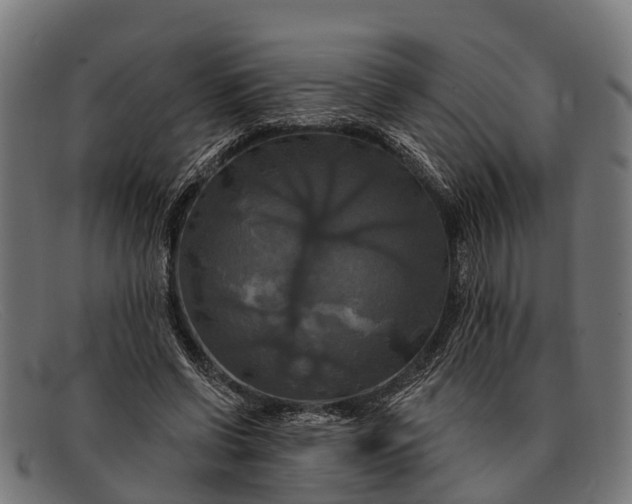 X0000091640542200709131433