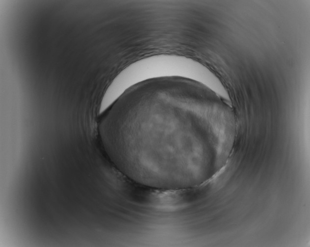 X0000091640186200709201115