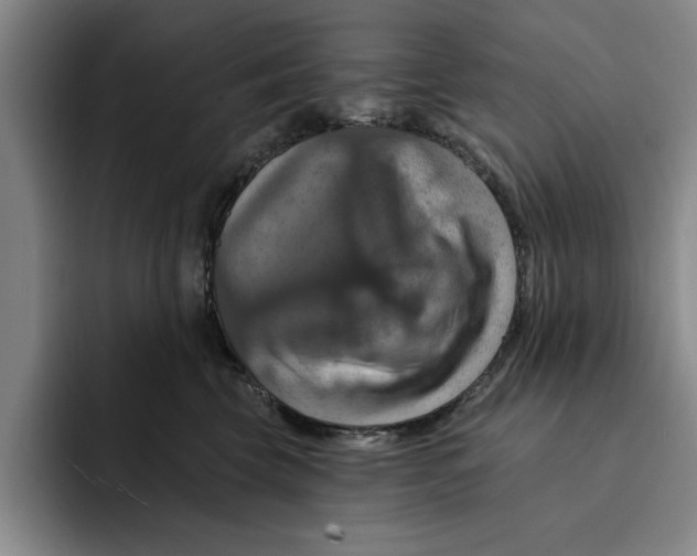 X0000091640569200709201110