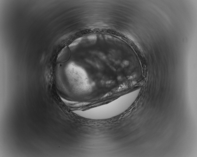 X0000091641063200709201104