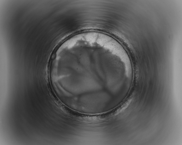 X0000091641121200709201103