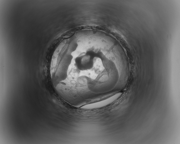 X0000091641159200709201103